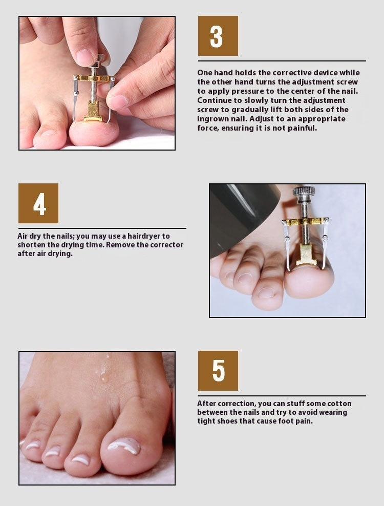 Nail Groove Embedded Nail Corrector Set Of Tools