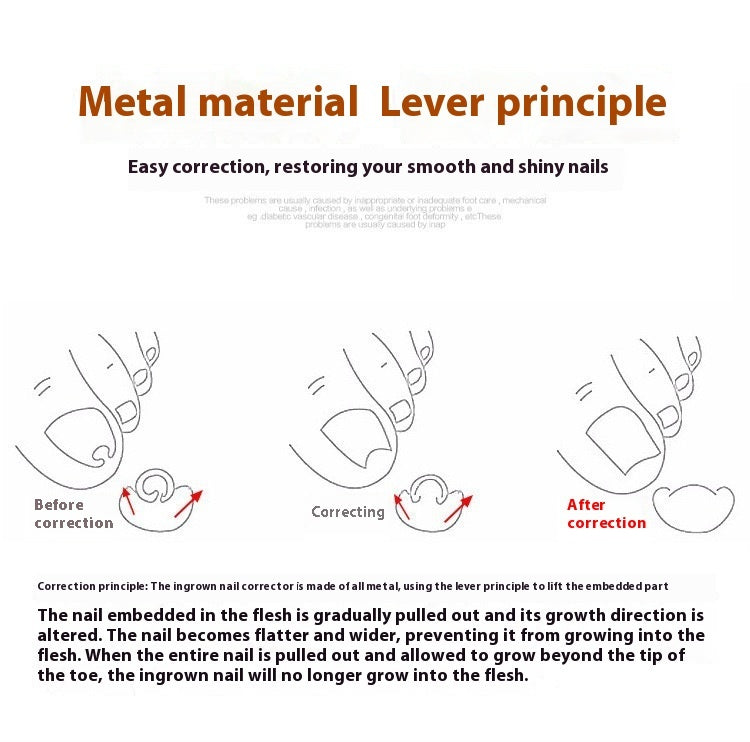 Nail Groove Embedded Nail Corrector Set Of Tools